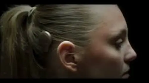 Implante de conducción ósea magnético